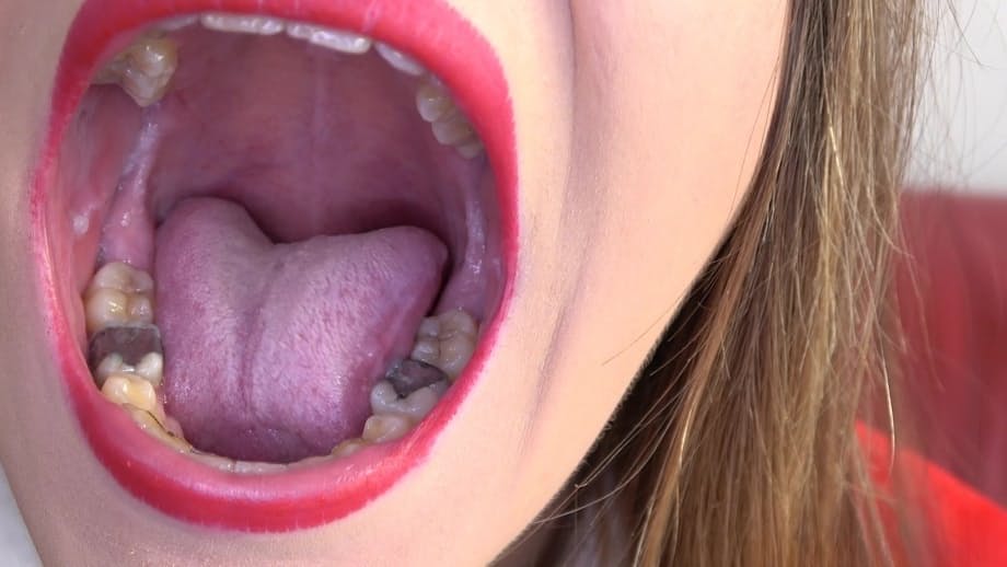 Dentist fucks her mouth while she wears Xmas outfit